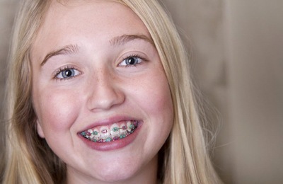 A young girl with metal braces.